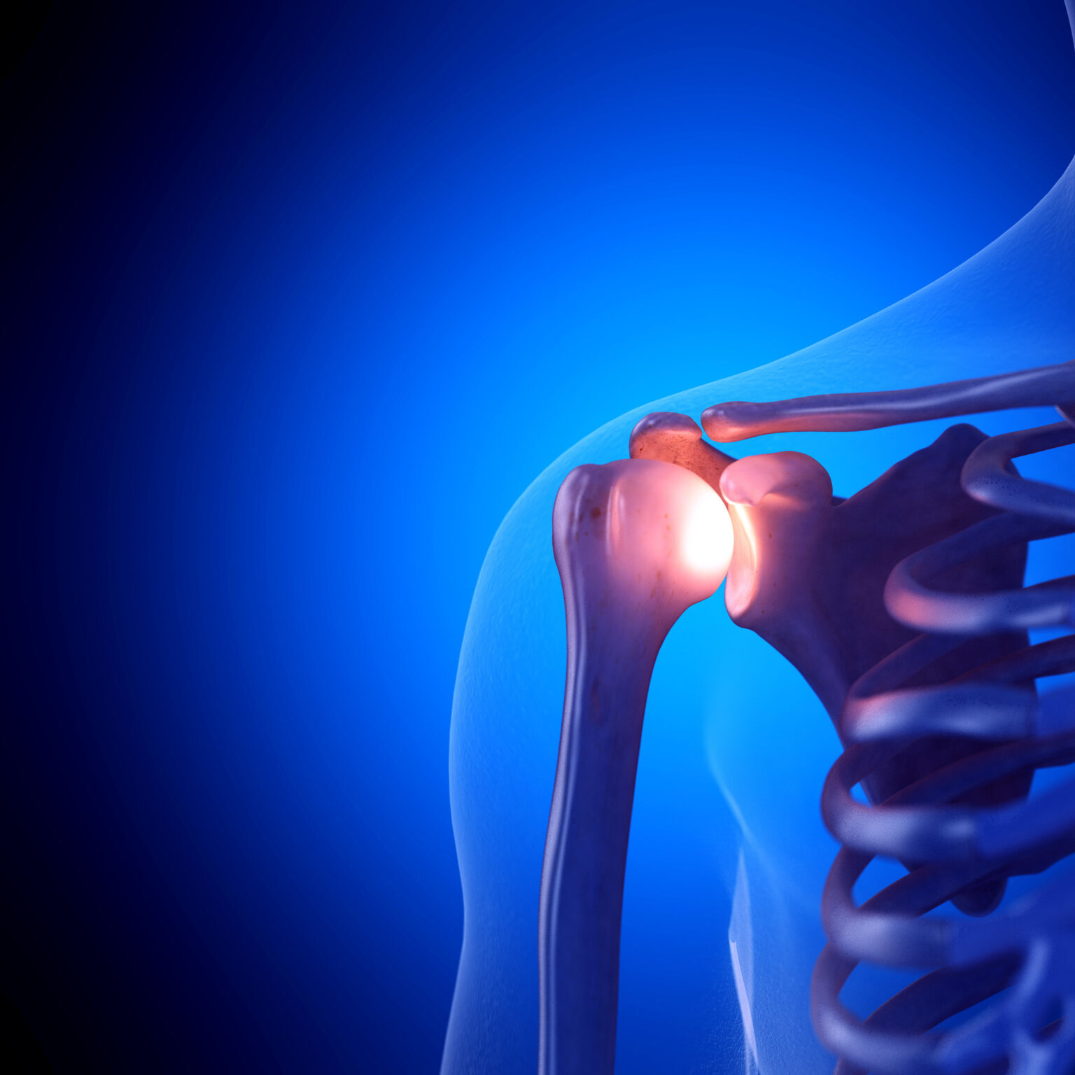 3d Rendered Medically Accurate Illustration Of A Painful Shoulder Joint 3d Rendered Medically Accurate Illustration Of A Painful Shoulder Joint