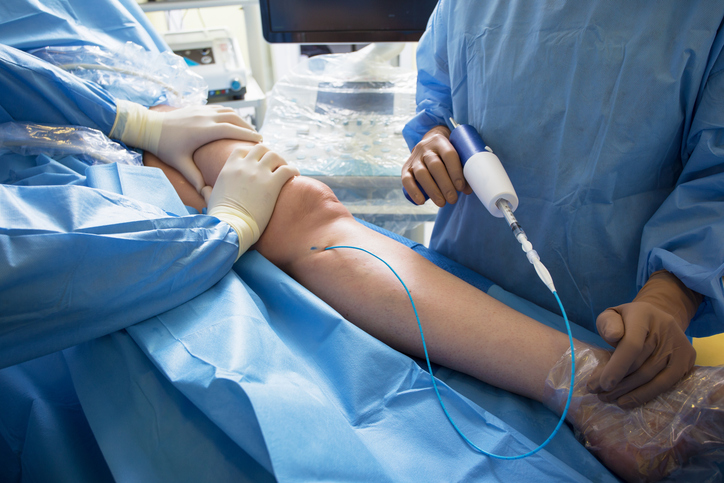 Doctors Doing Vein Surgery Procedure Doctors Doing Vein Surgery Procedure