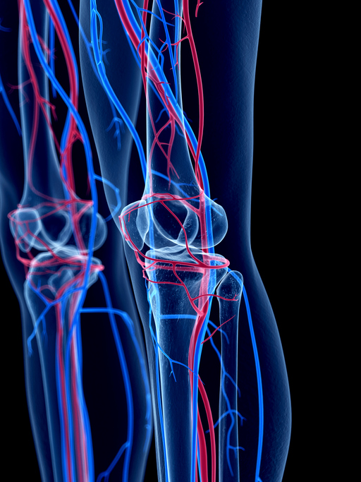 Genicular Artery Embolization Genicular Artery Embolization